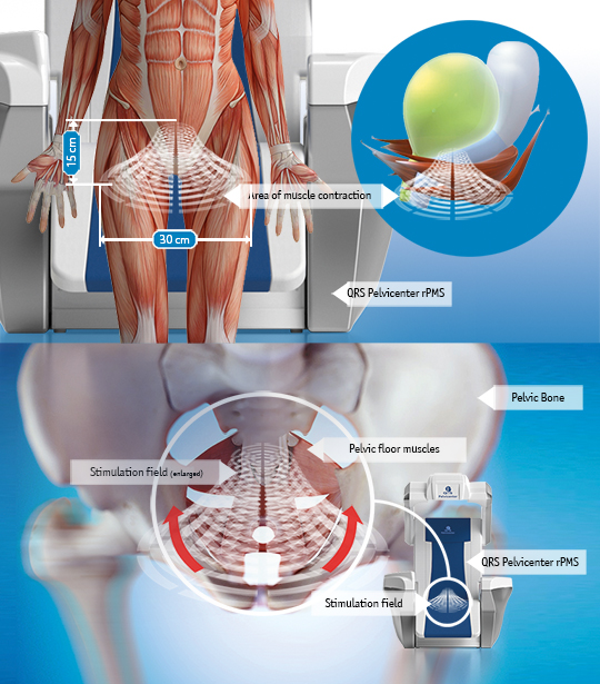 QRS Pelvicenter muscle stimulation chart