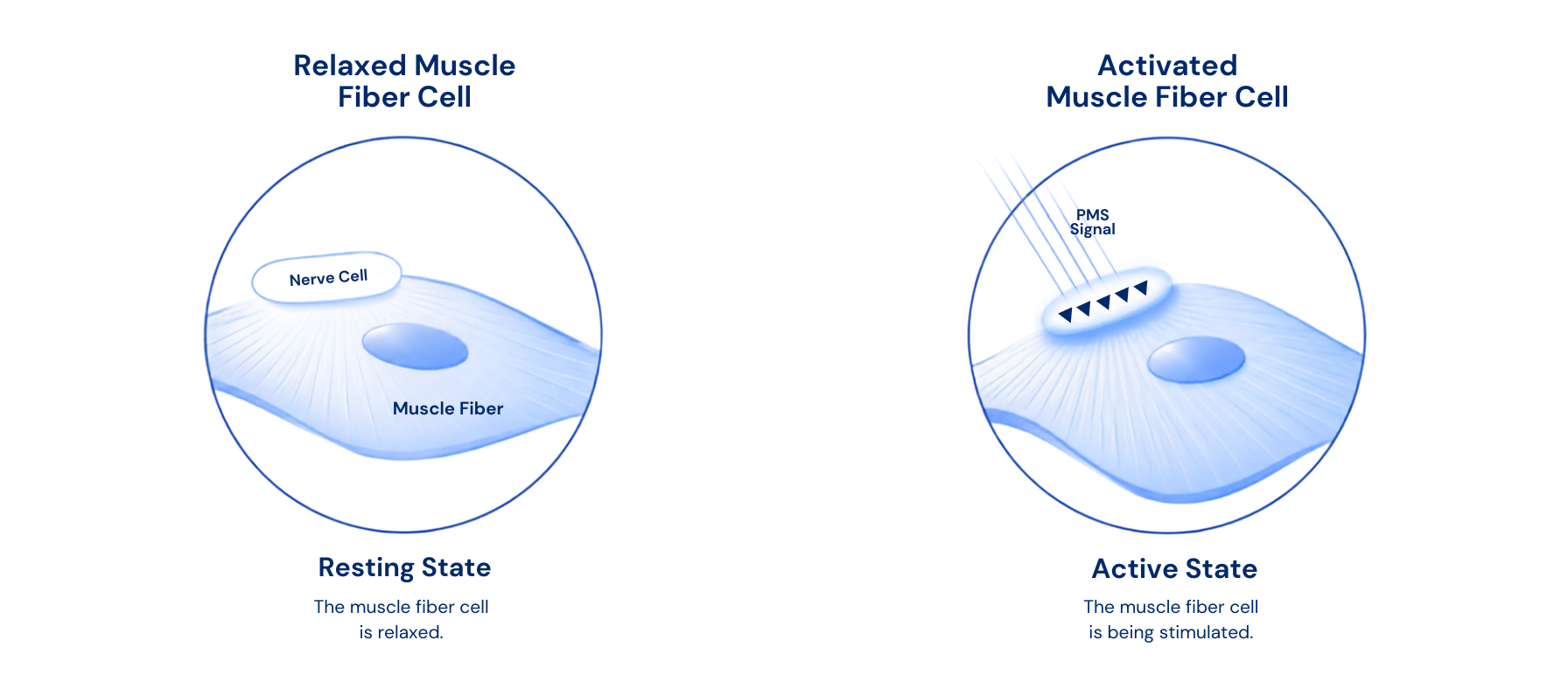 QRS magnetic stimulation effect on muscle fibers